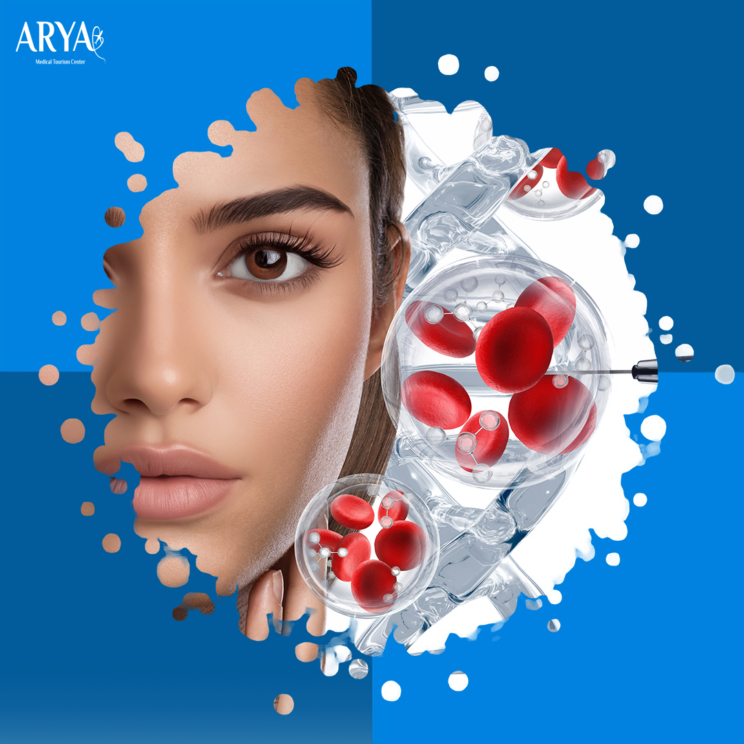 حقن البلازما